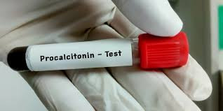 (PCT) Procalcitonin  Test