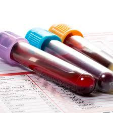 Serum-Based High-Purity Transferrin Test for  Immunoturbidometry