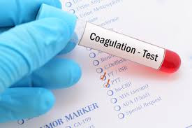 Coagulation Profile Test