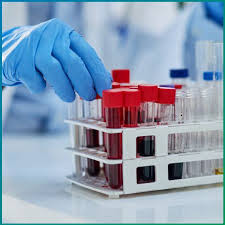 Free Androgen Index Test