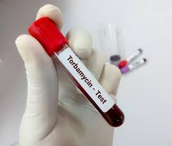 Tobramycin , Serum Test