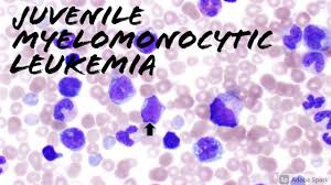 Oncomine (JMML) Juvenile myelomonocytic Leukemia  panel