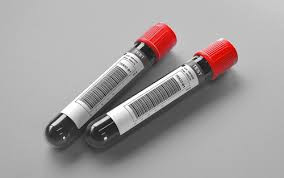 High-Purity Homovanillic Acid (HVA) Test