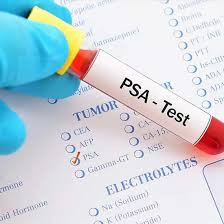 Prostate Profile Test