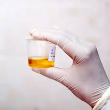 (Random Urine)  Lead Test Kit