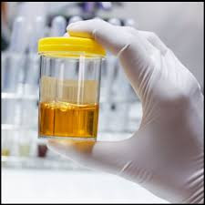 Porphyrins (Random Urine) Qualitative Test