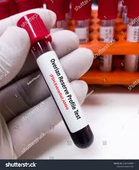 Ovarian Function Profile Test
