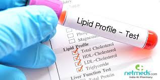 Lipid Profile II Test