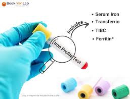 (Iron, TIBC)  Transferrin Saturation Test – Accurate Serum Analysis for Iron Metabolism & Deficiency Detection