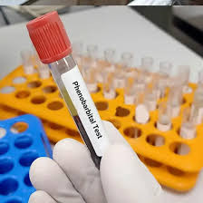 Phenobarbital Serum Test