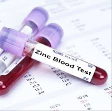 Zinc (Serum Test)