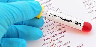 Cardiac Injury Markers II Test